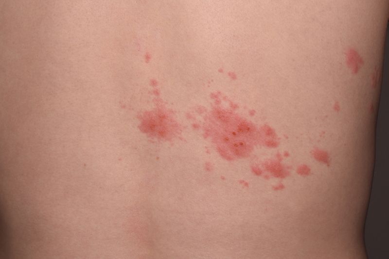 02e8f9e518ff1ae973bb740285115113_1776049757_569.jpg 02e8f9e518ff1ae973bb740285115113_1776049757_569.jpg